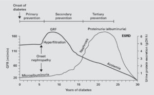 糖尿病性腎症の自然史の仮説
